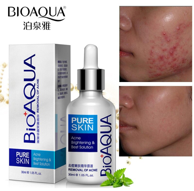 KIT BIOAQUA ANTIACNE 3 x 1