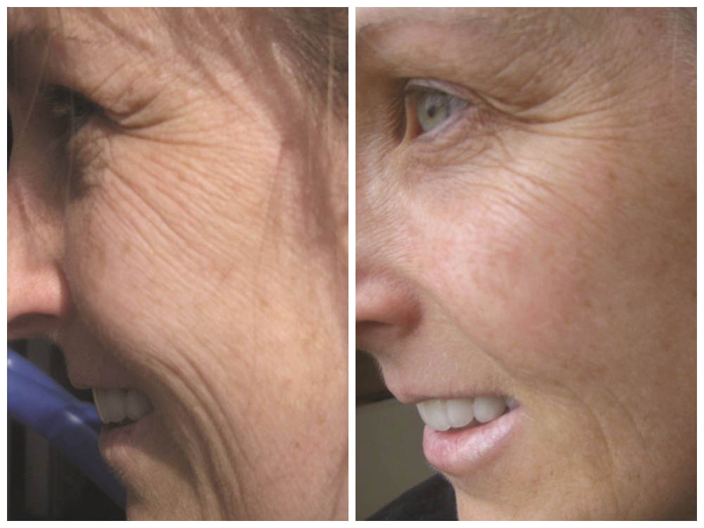 BIOAQUA ANTIEDAD - PIEL RENOVADA™