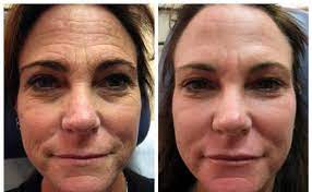 BIOAQUA ANTIEDAD - PIEL RENOVADA™